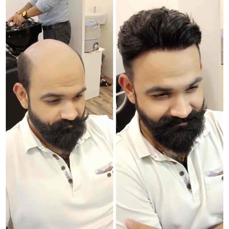 Top 100 Men Beauty Parlours For Hair Weaving In Jaipur Best