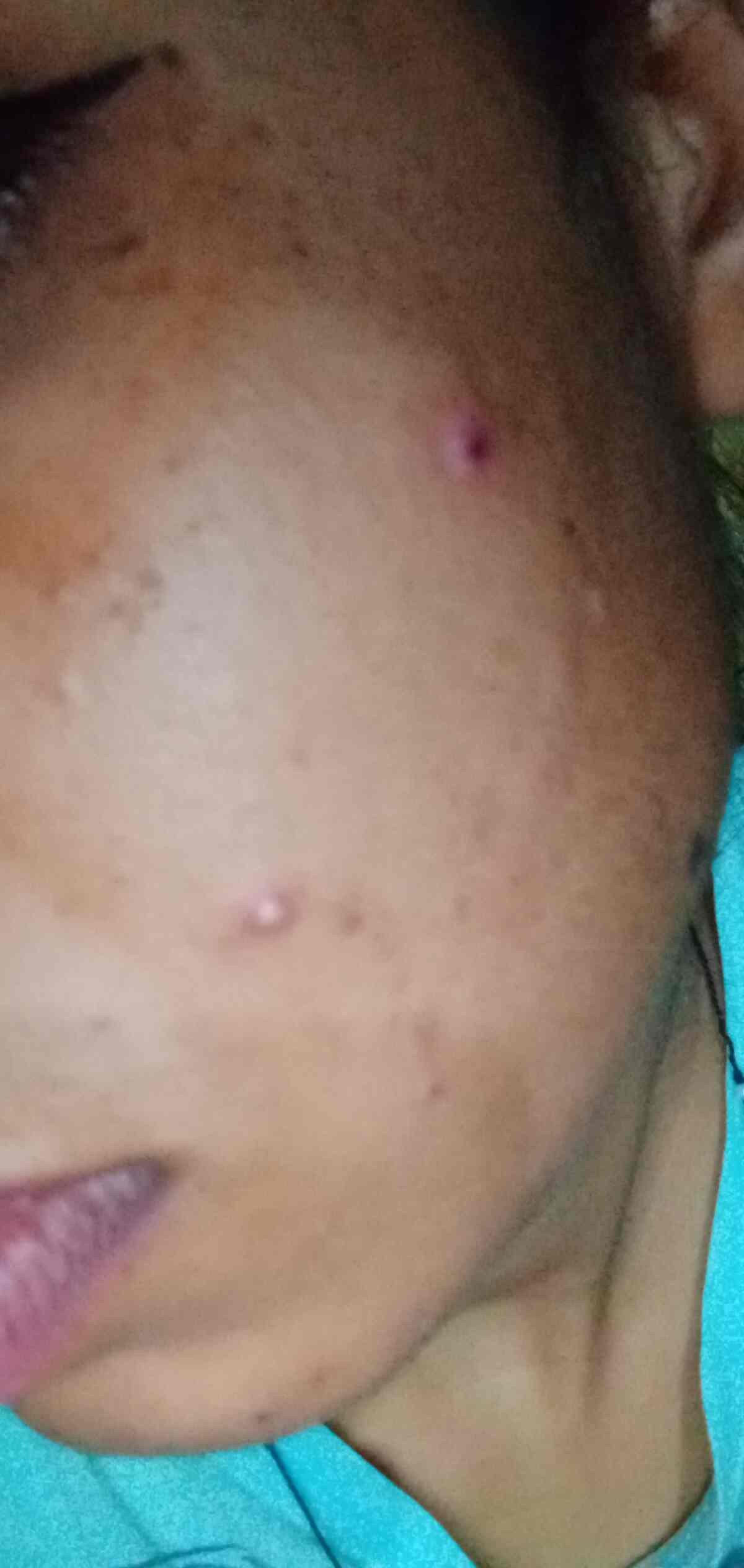 Sood Skin Care & Laser Centre in Model Town,Jalandhar Book