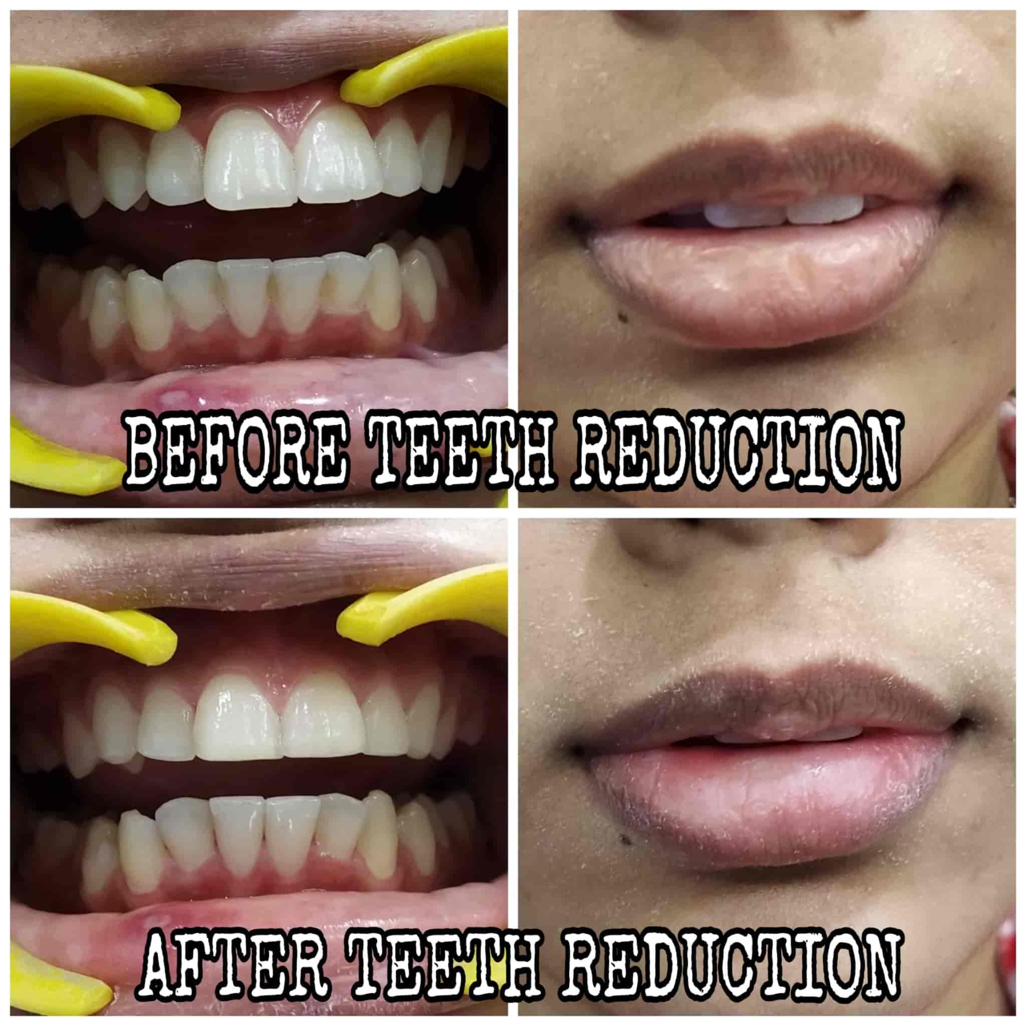 Sai Sharma Dental Clinic in Jalandhar Cantt,Jalandhar Best Dentists