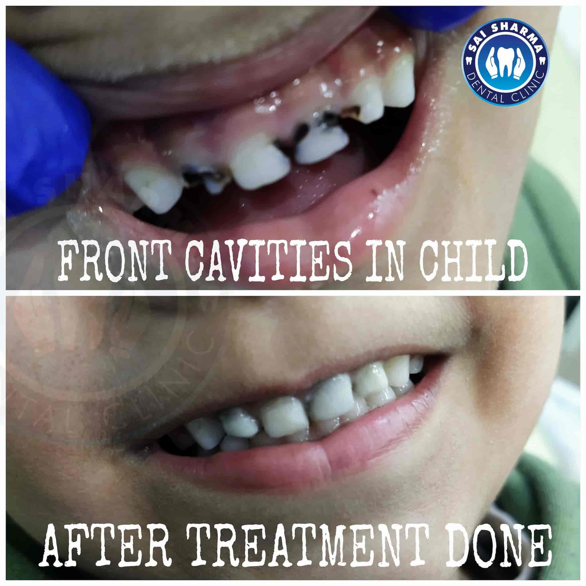 Sai Sharma Dental Clinic in Jalandhar Cantt,Jalandhar Best Dentists