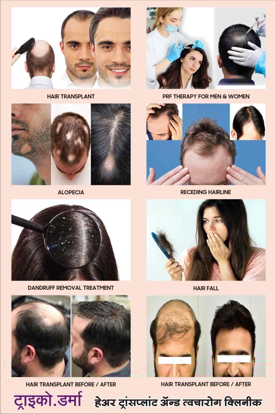 Tricho Derma (The Hair Transplant And Skin Clinic) in Jalgaon Bazar