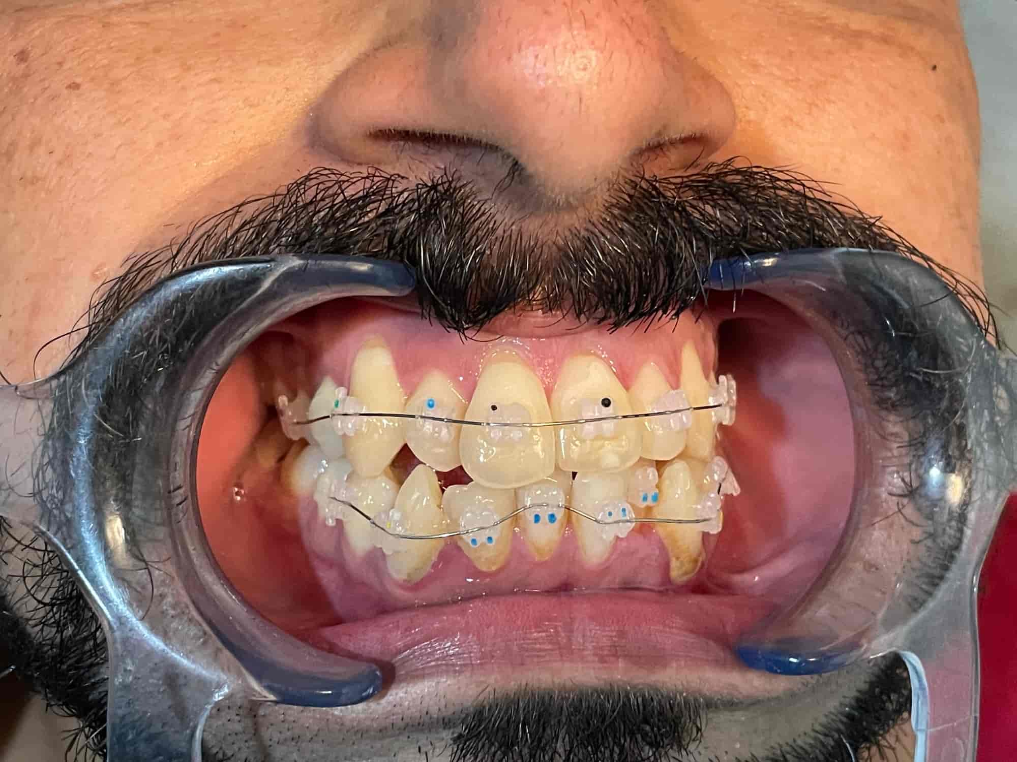 Mulberry Molar Dental Clinic in Janipur Jammu Best Dental