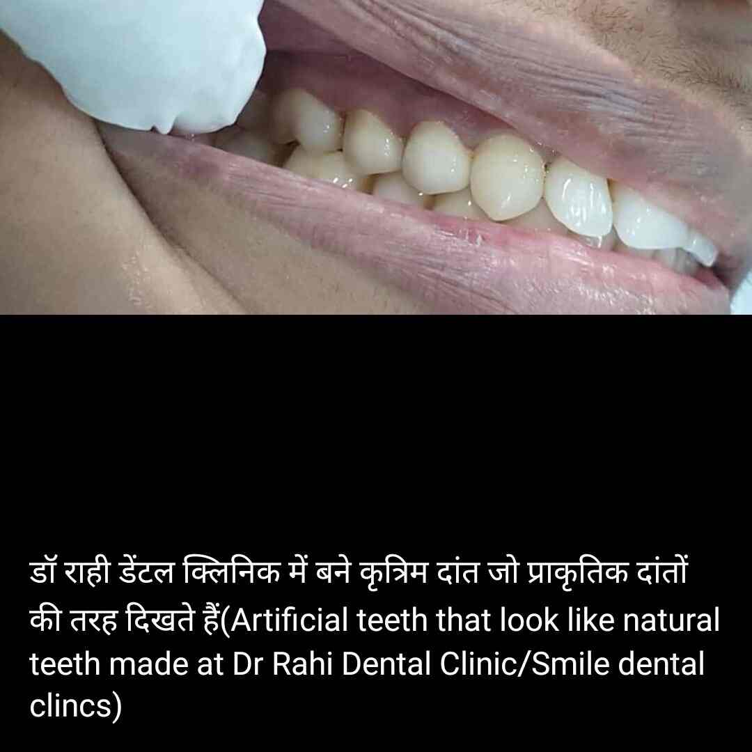 Dr. Rahi Dental Care in Mango,Jamshedpur Best Dental Clinics in