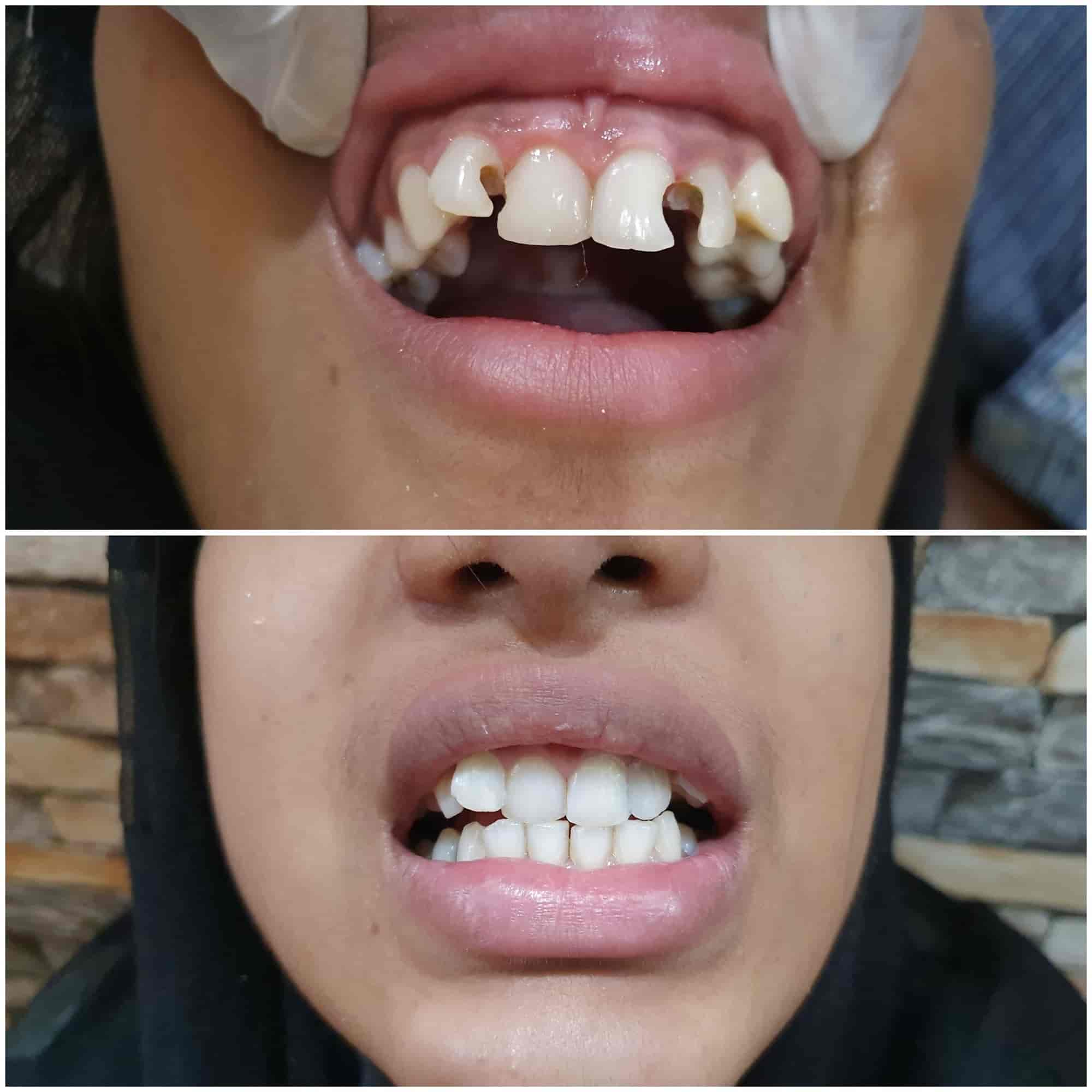 Dr. Rahi Dental Care in Mango,Jamshedpur Best Dental Clinics in