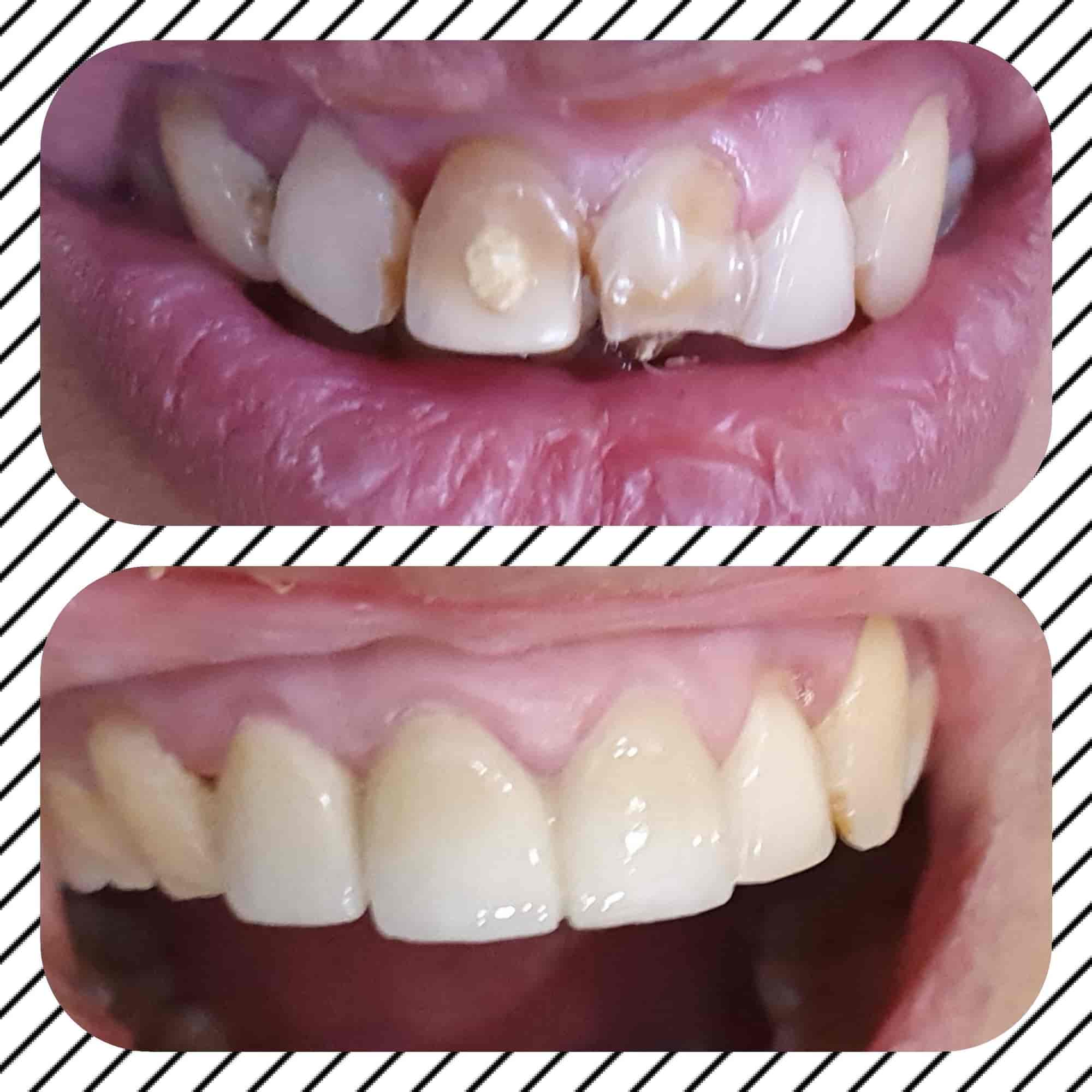 Dr. Rahi Dental Care in Mango,Jamshedpur Best Dental Clinics in