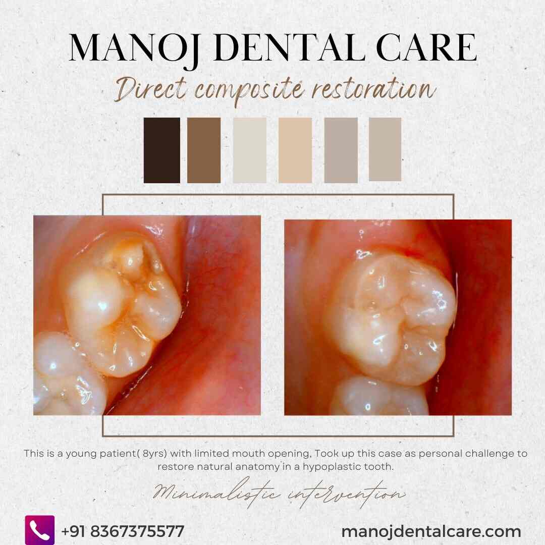 Manoj Dental Care in Ramaraopeta,Kakinada Best Dental Hospitals in