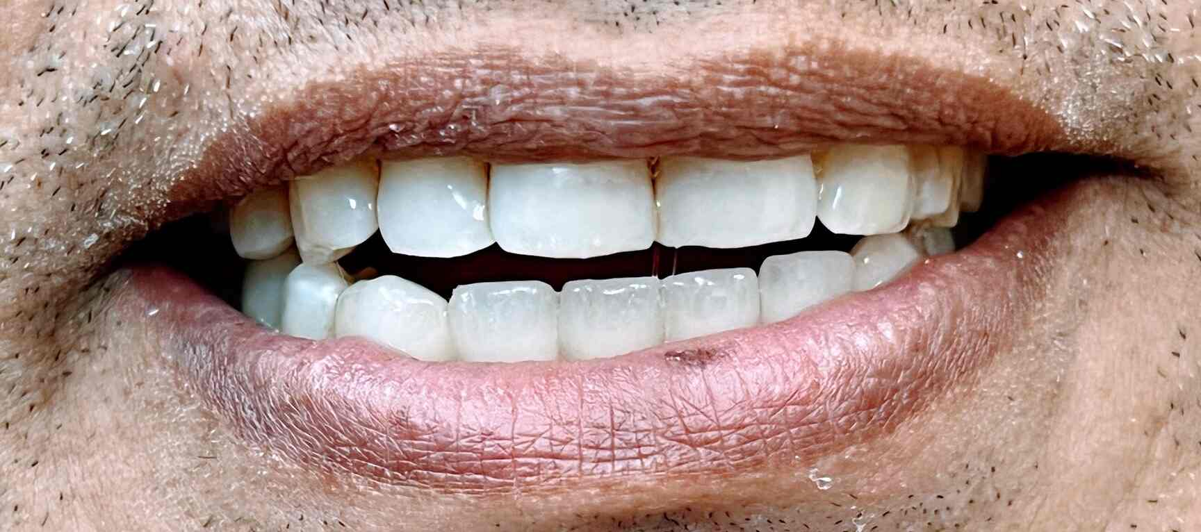 Kalyan Dental Clinic in Kalyan West,Mumbai Best Dental Surgeons in