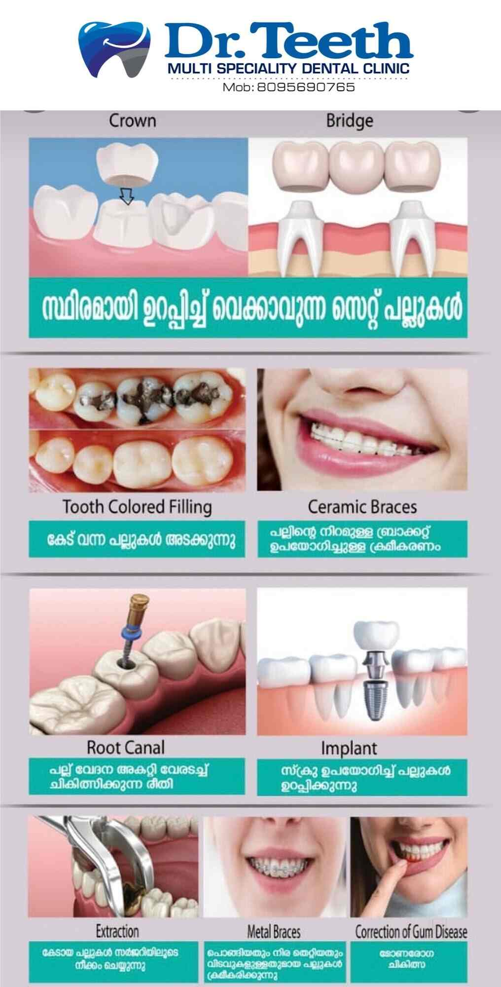 Dr. Teeth Multi Speciality Clinic in Onapparamb Road,Kannur Best