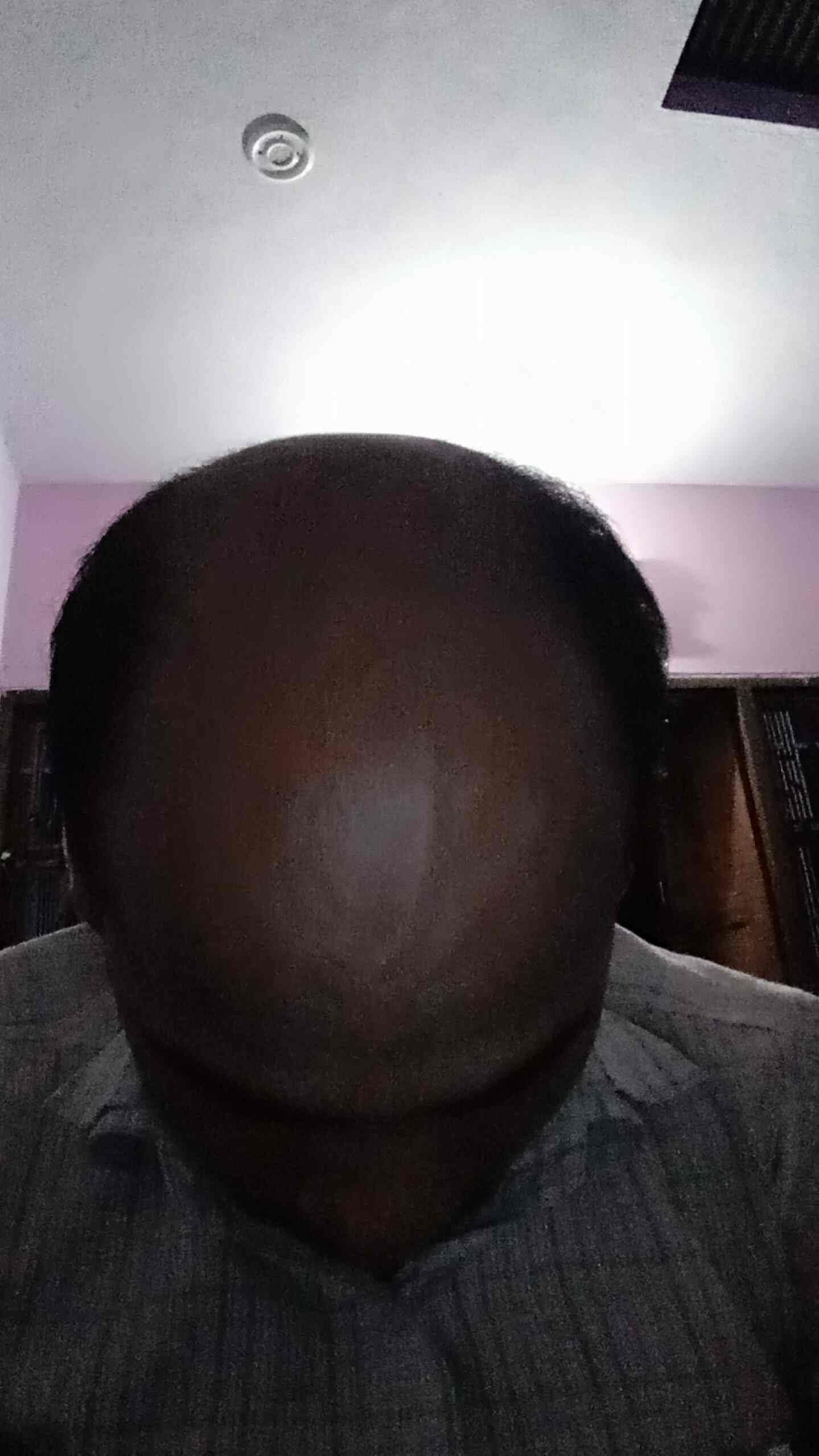 The Sparsh Clinic Skin Care & Hair Transplant Centre in Kanpur Best