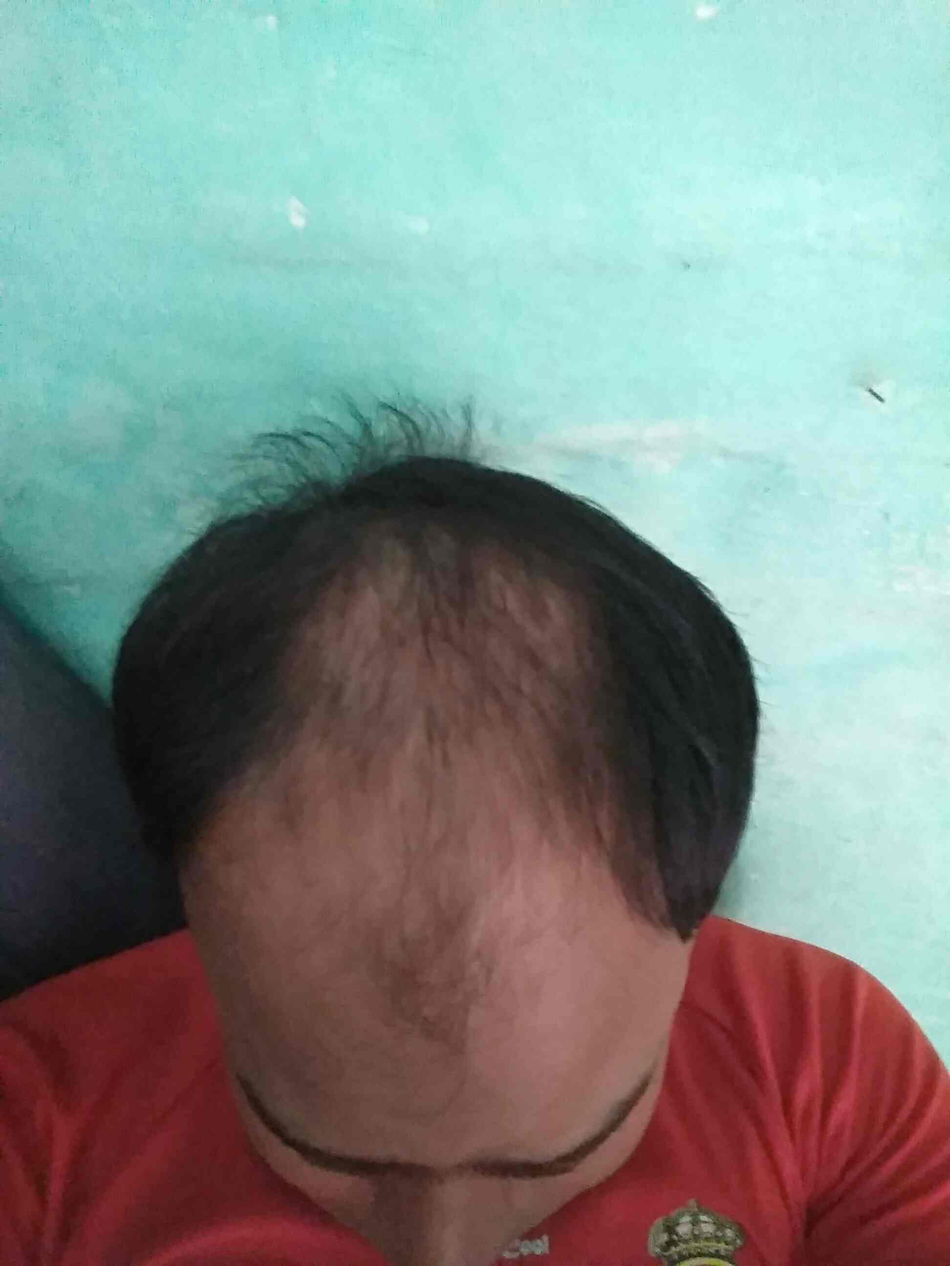 The Sparsh Clinic Skin Care & Hair Transplant Centre in Kanpur Best