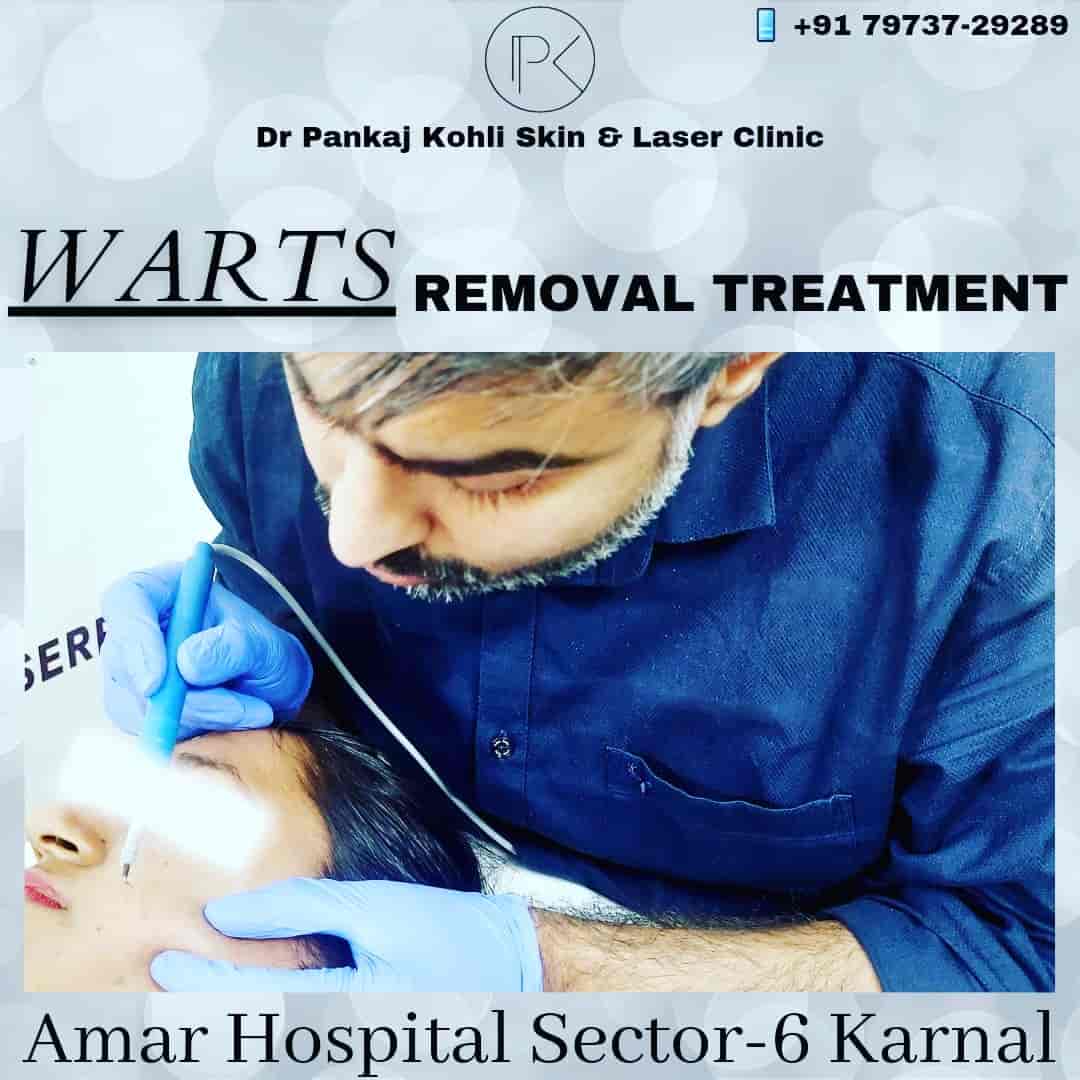 Top Dermatologists in Gt Road, Karnal Best Skin Specialist near me