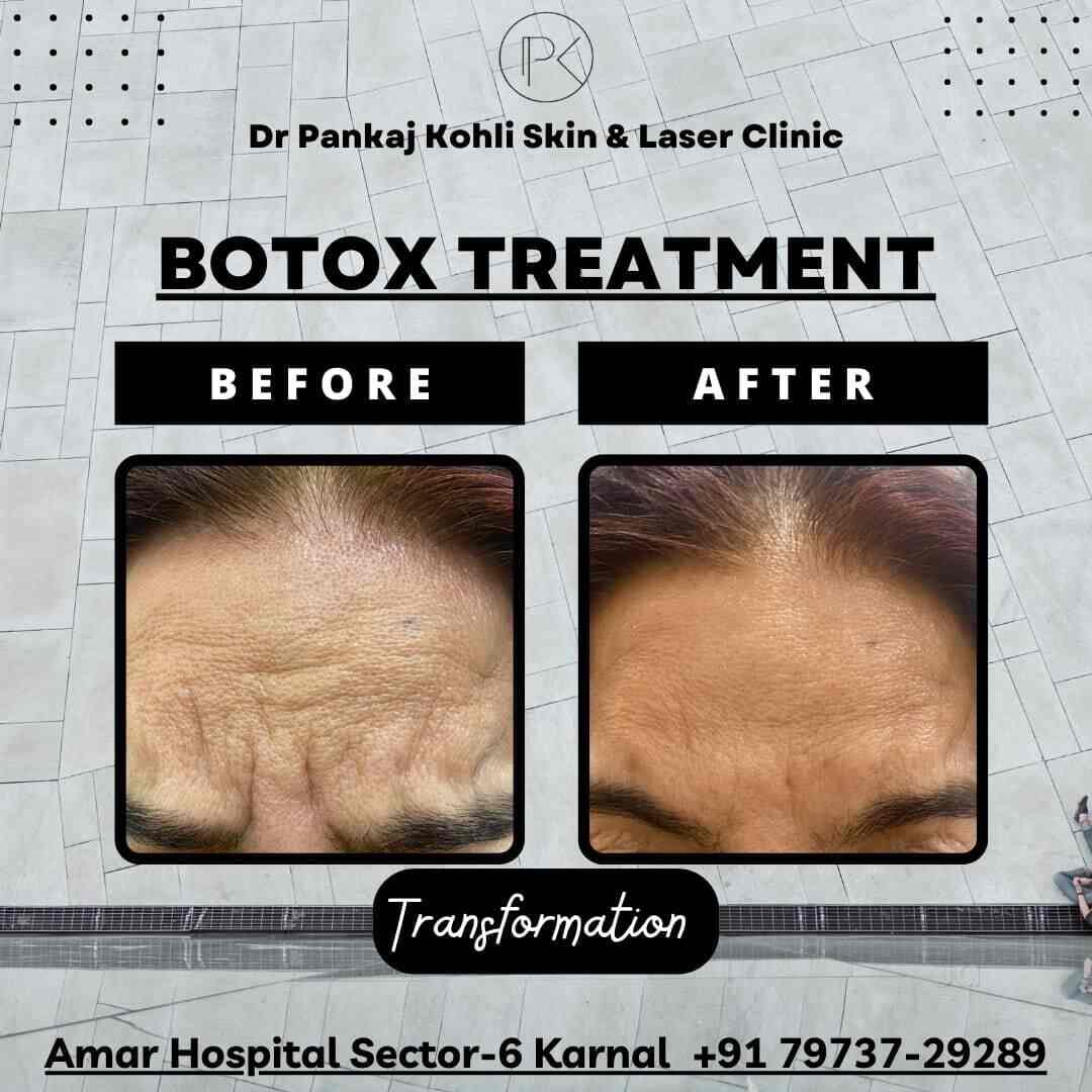 Top Dermatologists in Gt Road, Karnal Best Skin Specialist near me