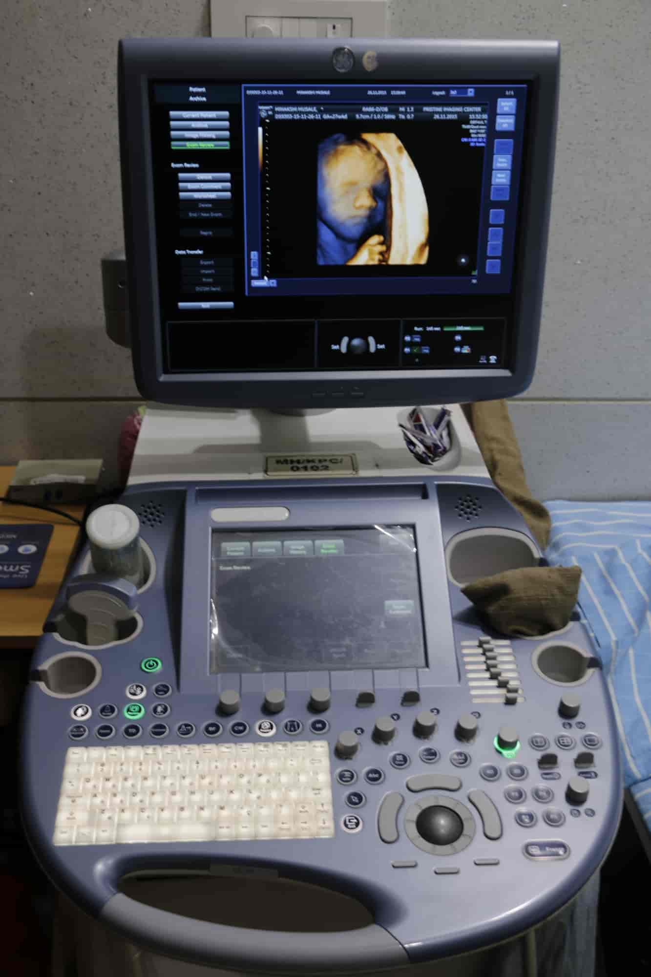 Top 3d Sonography Centres in Kale Best 3d Ultrasound Scan Centres