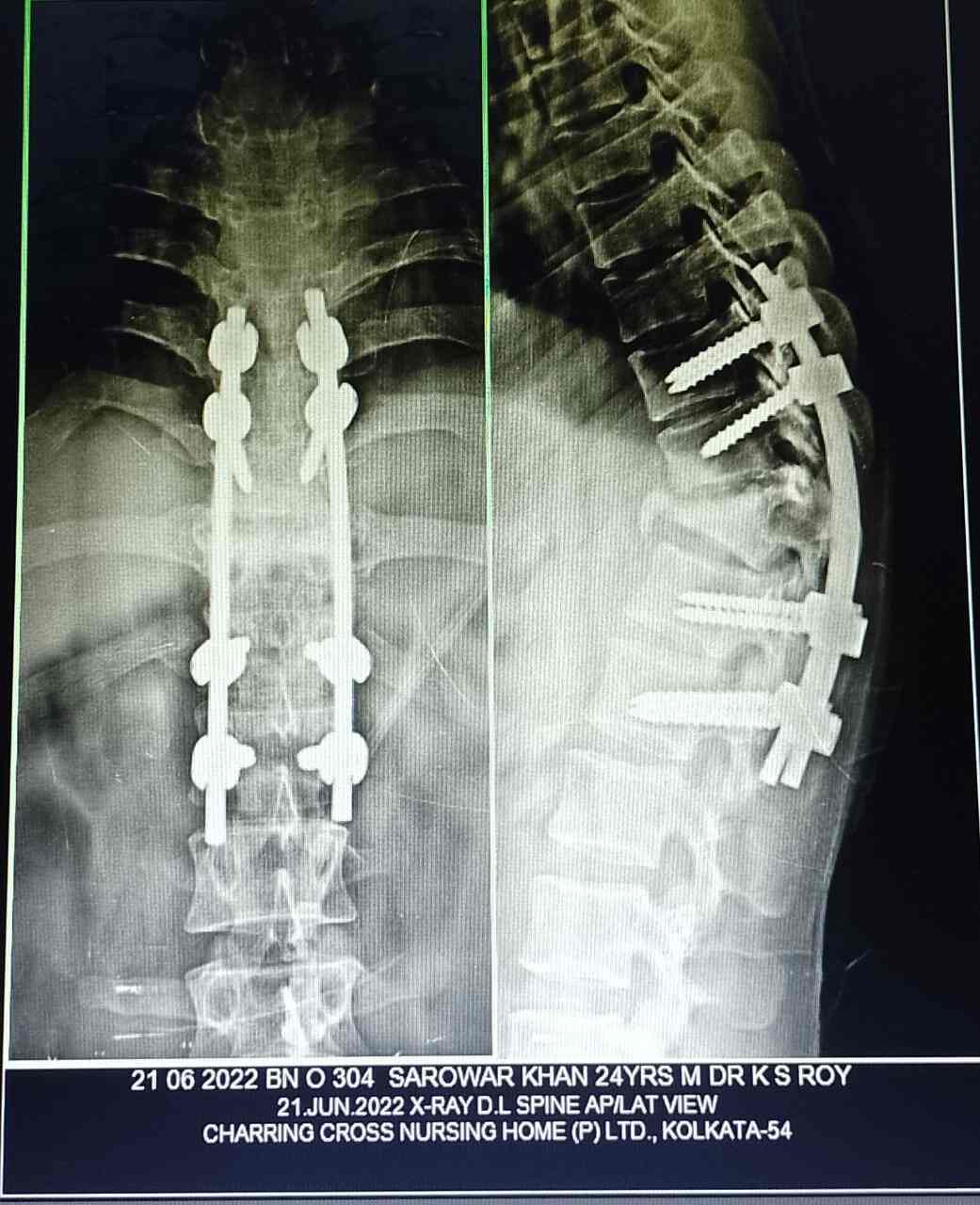 Orthopaedic Surgeons in Mukundapur, Kolkata Orthopaedic Doctors