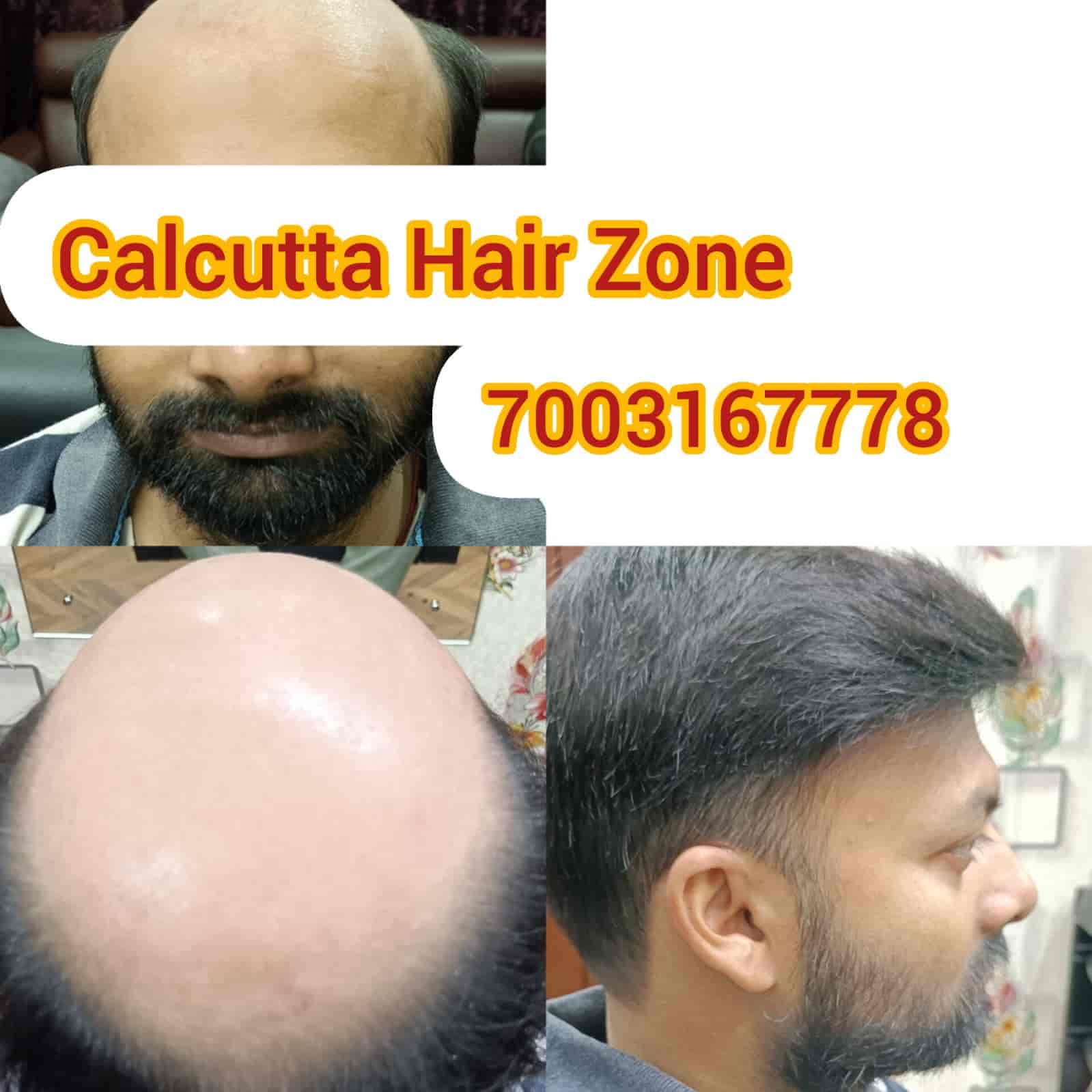 Top Hair Patch Dealers in Kolkata near me Justdial