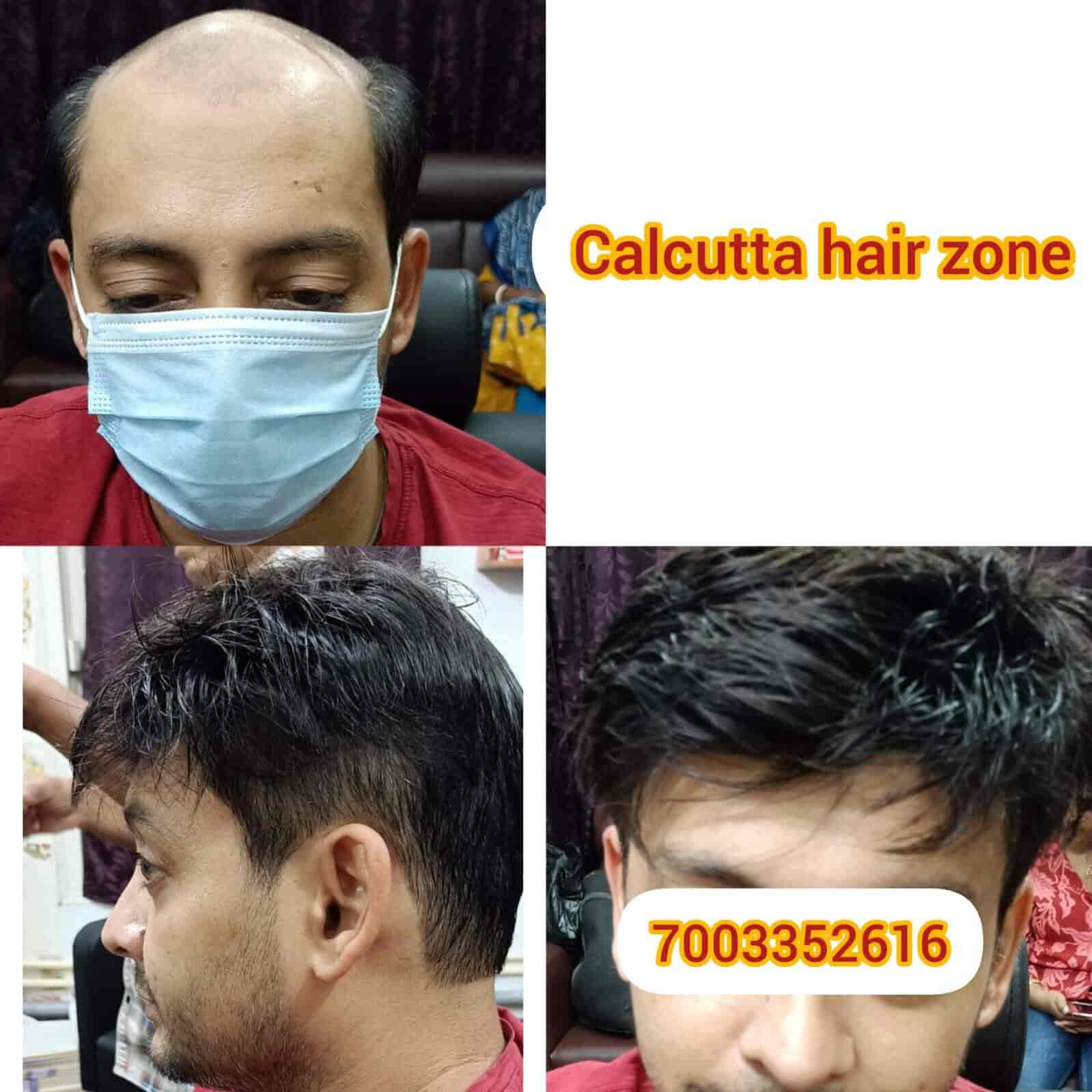 Top Hair Patch Dealers in Kolkata near me Justdial