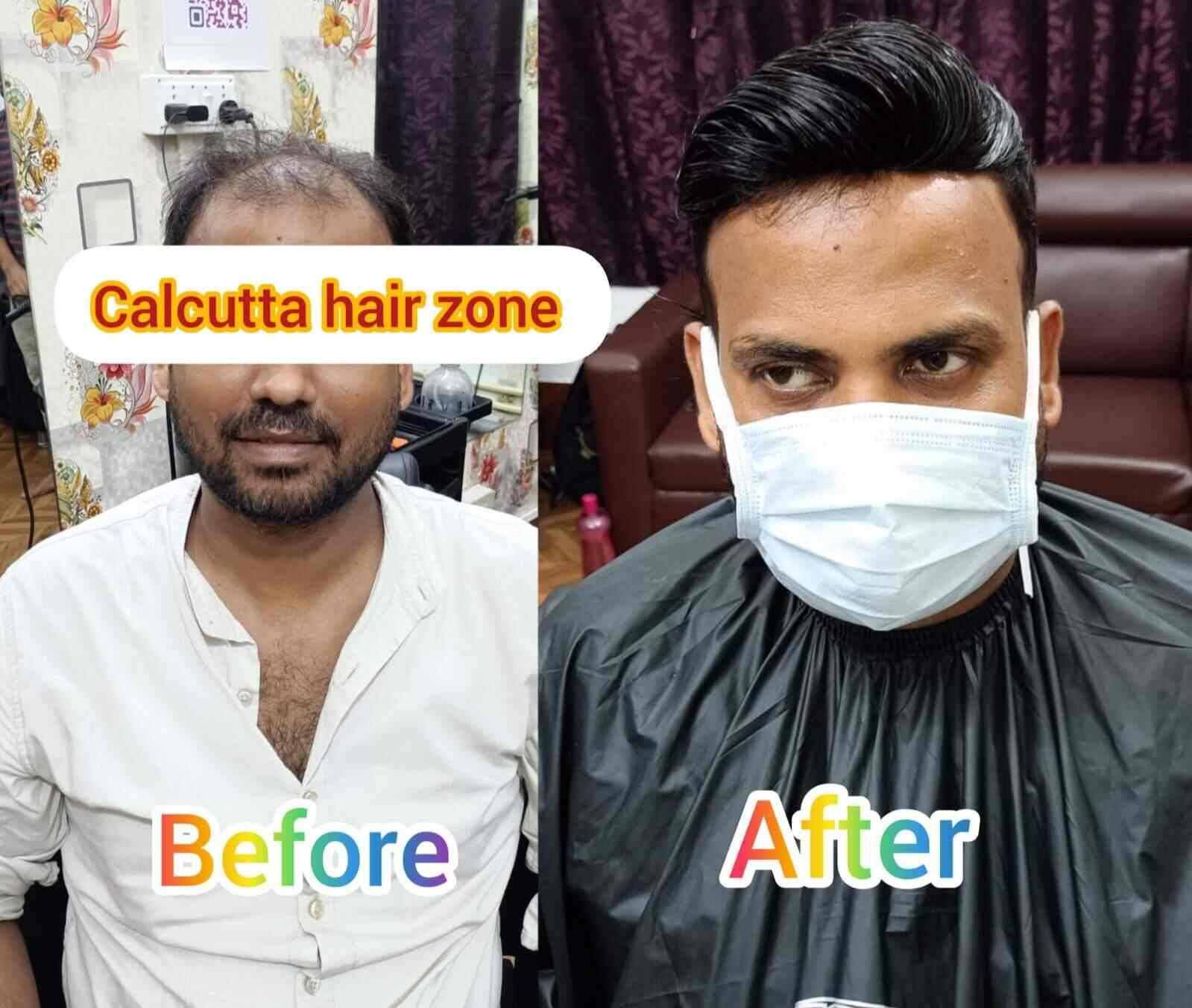 Top Hair Patch Dealers in Kolkata near me Justdial