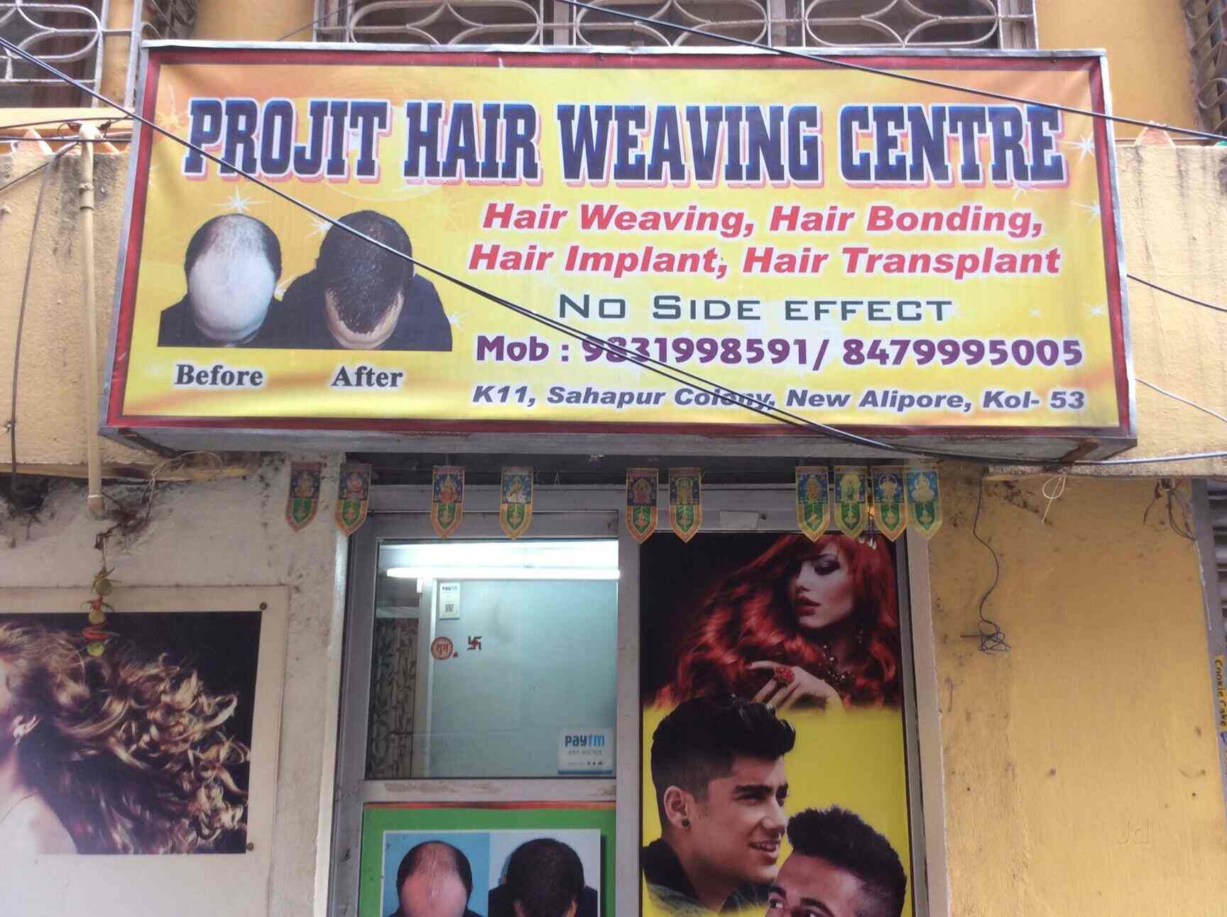 Top 50 Hair Transplant Clinics In Kolkata Best Hair Transplant