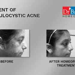 Dr. Batras Healthcare in Salt Lake City Sector 5,Kolkata - Book Appointment Online - Best Dermatologists in Kolkata - Justdial Dr. Batras Healthcare in Salt Lake City Sector 5,Kolkata - Book Appointment Online - Best Dermatologists in Kolkata - Justdial