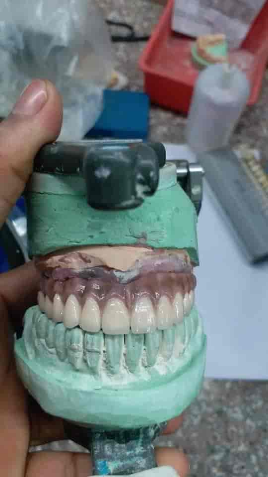 Top Dental Laboratory in Shyamapally Best Dental Labs Kolkata near me