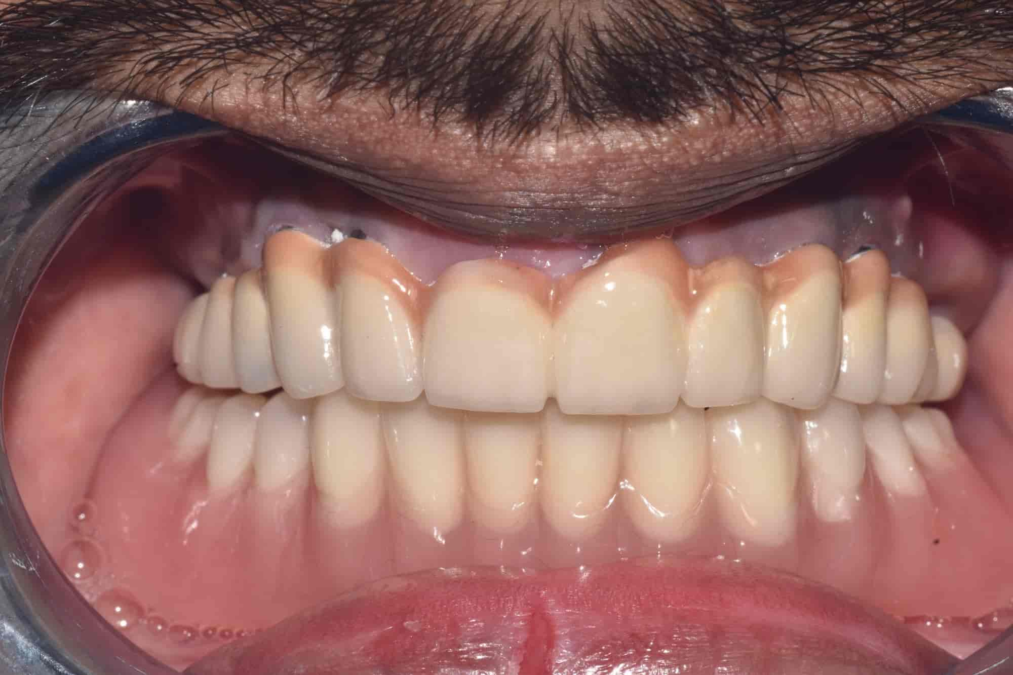 Holy Smile Advanced Dental Care And Polyclinic in Beniapukur,Kolkata Book Appointment Online