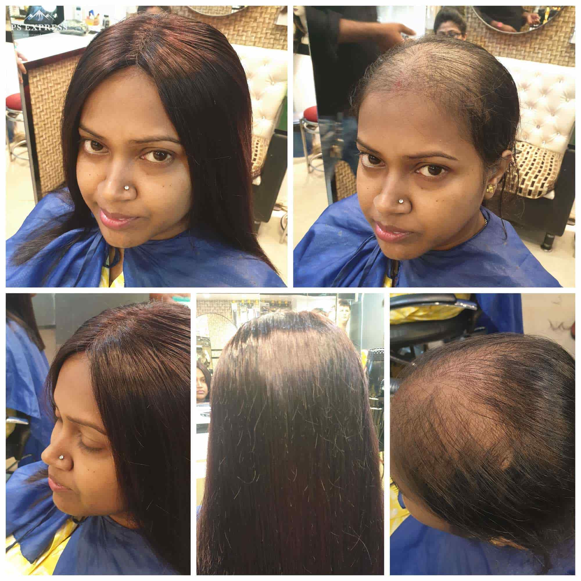 ladies hair wigs kolkata