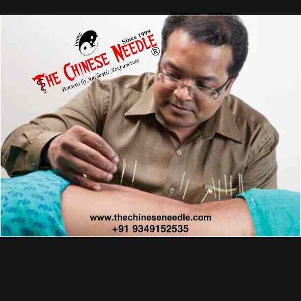 Top Acupuncture Doctors in Nagercoil Best Acupuncturists Justdial