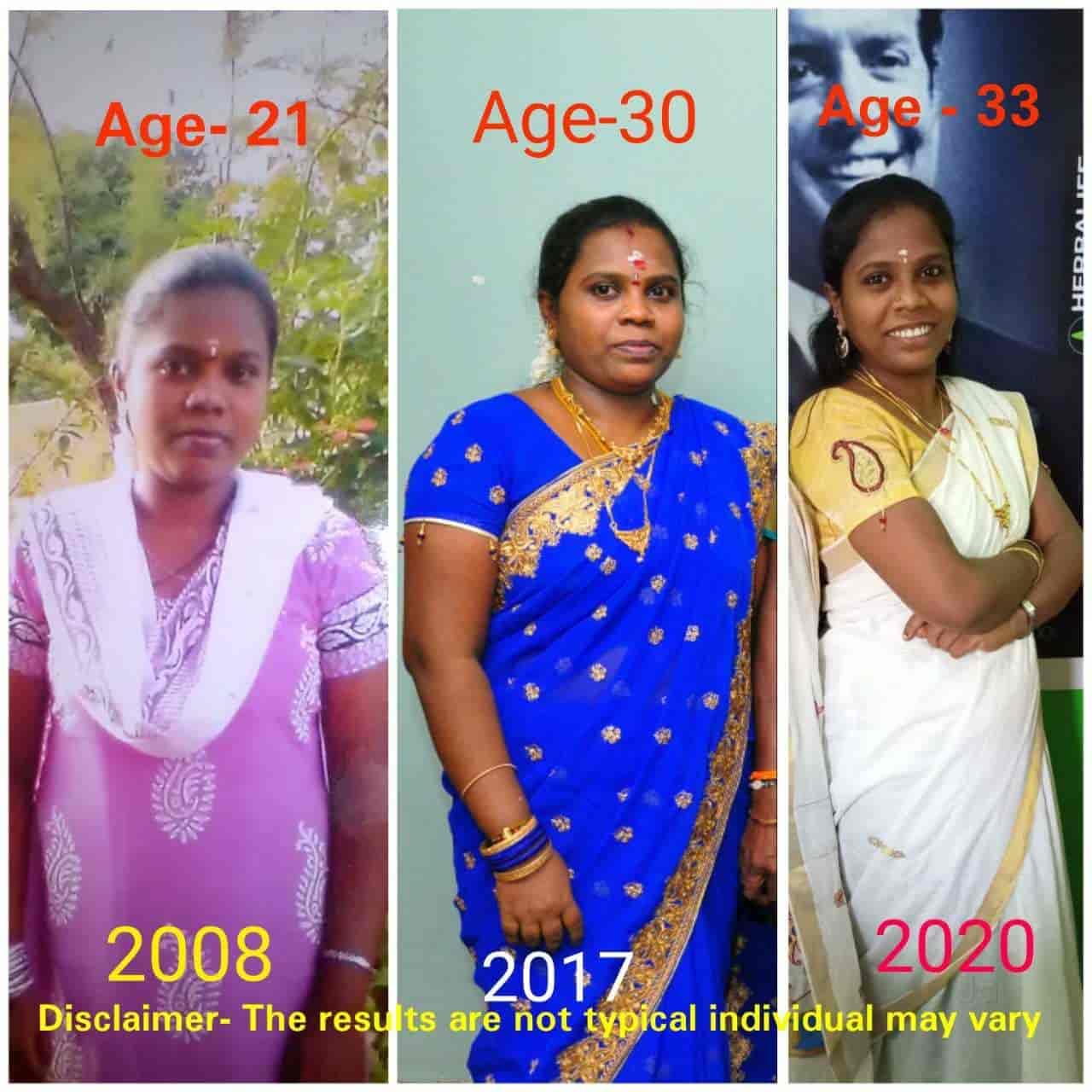 Top Weight Loss Centres For Lymphatic Drainage in Madurai near me