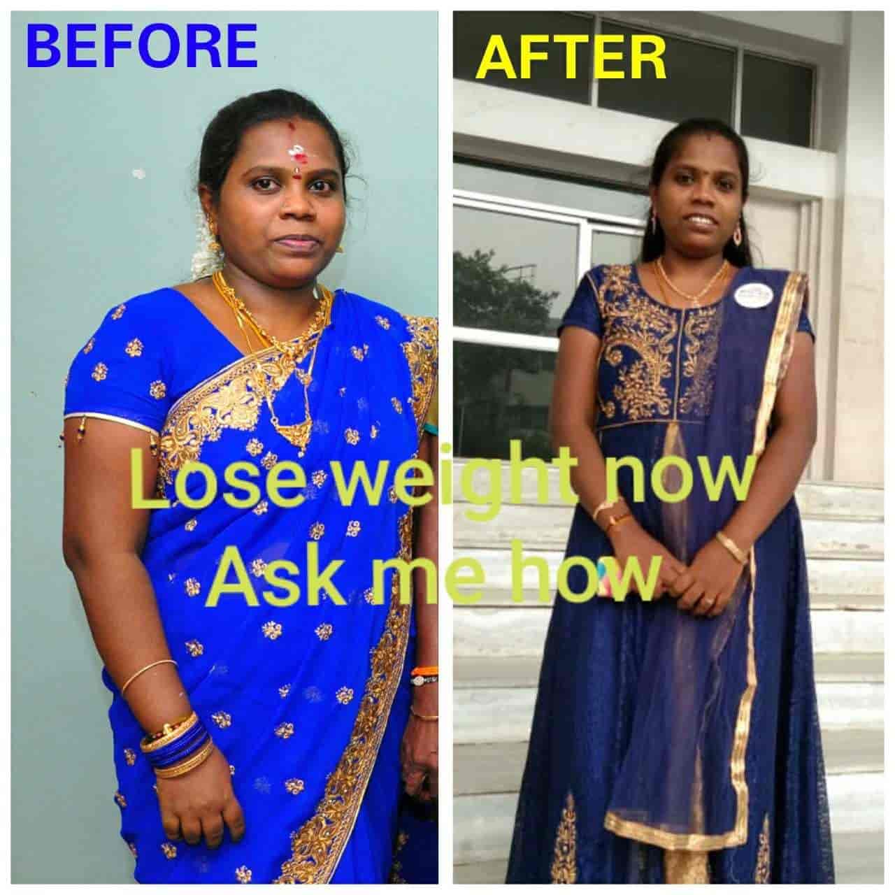 Top Weight Loss Centres For Lymphatic Drainage in Madurai near me