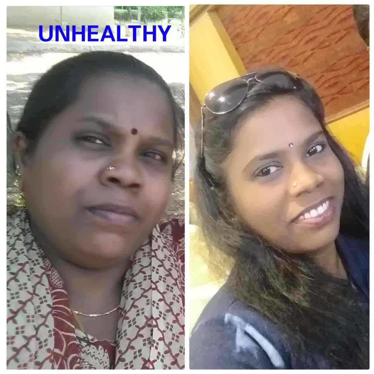 Top Weight Loss Centres For Lymphatic Drainage in Madurai near me