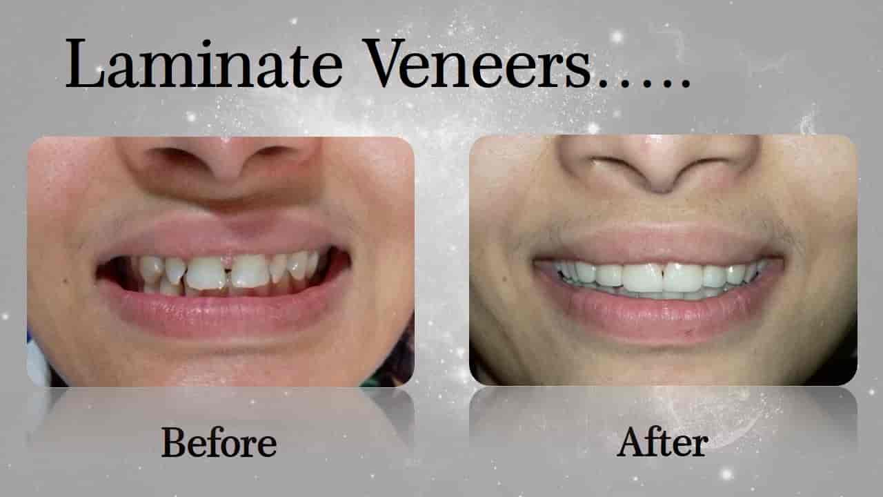 17 Tricks About dental center Dwarka sector 7 You Wish You Knew Before