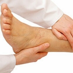 venicile varicose medication tratament