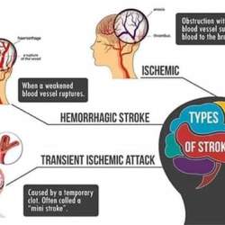 Top Physiotherapists For Spine Injuries in Gomti Nagar, Lucknow ...