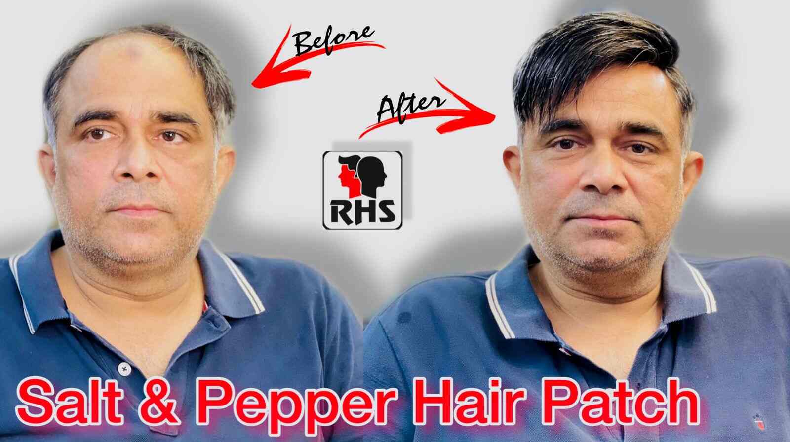 Lucknow Branch | Rizy Hair Solution | Rizy hair Solution