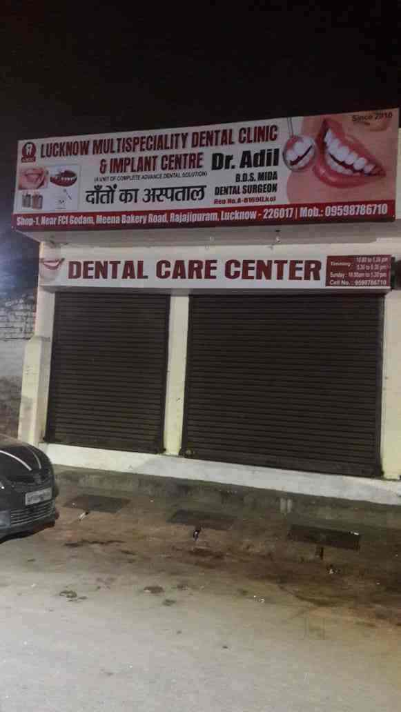 Lies And Damn Lies About tooth veneers How to start With tooth veneers