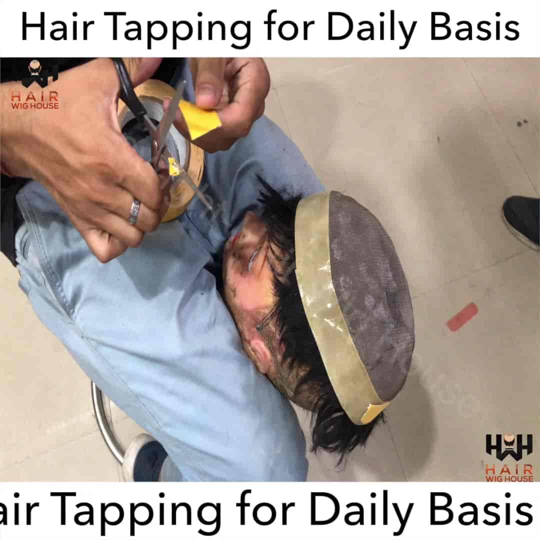 Hair Wig House in Gomti Nagar,Lucknow Best Hair Treatment Clinics in