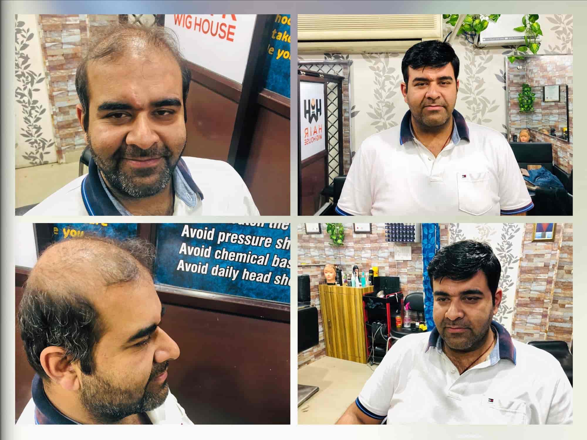 Hair Wig House in Gomti Nagar,Lucknow Best Hair Treatment Clinics in Lucknow Justdial