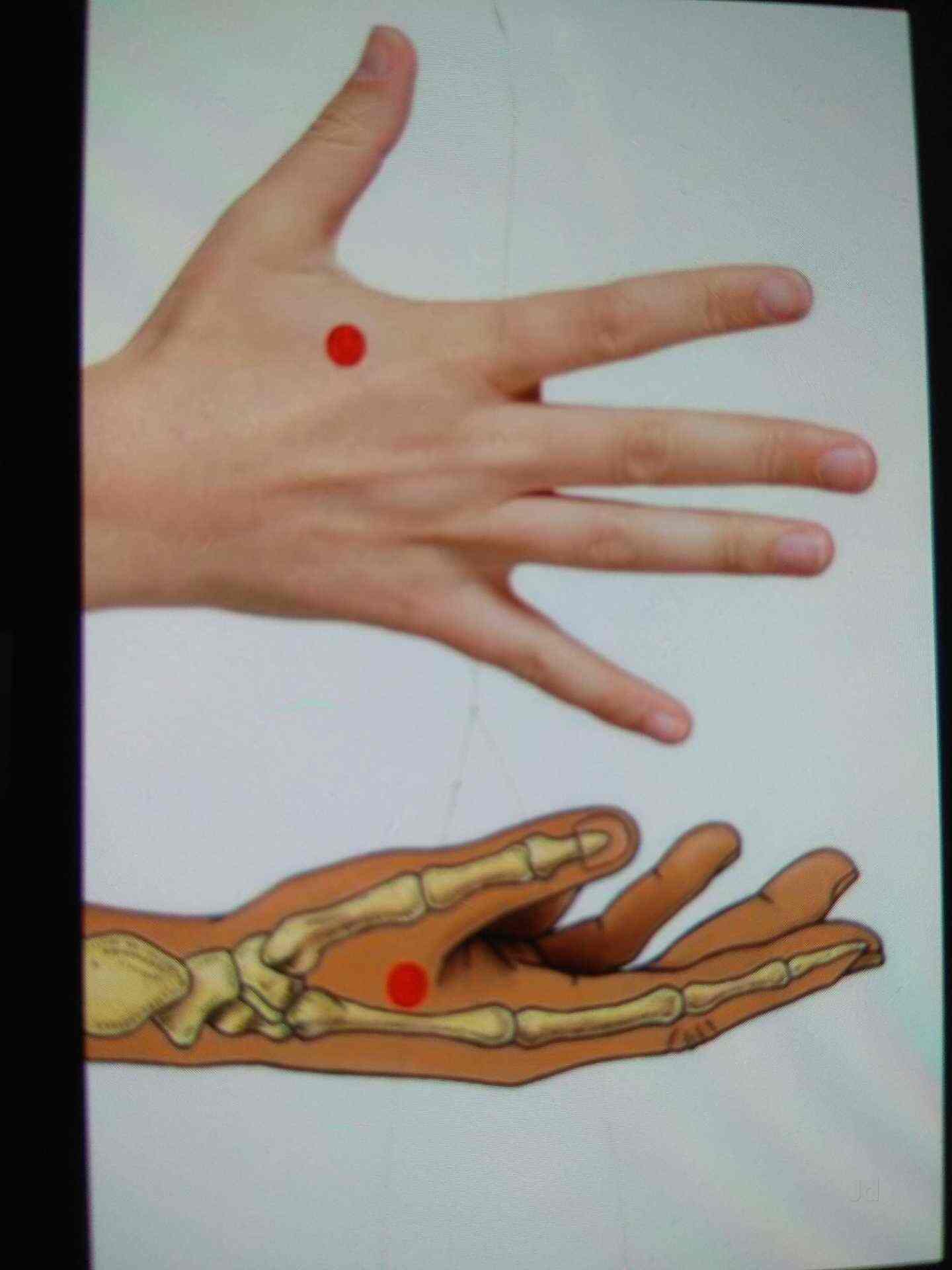 Top Acupressure Therapists For Migraine in Jalandhar Book Appointment