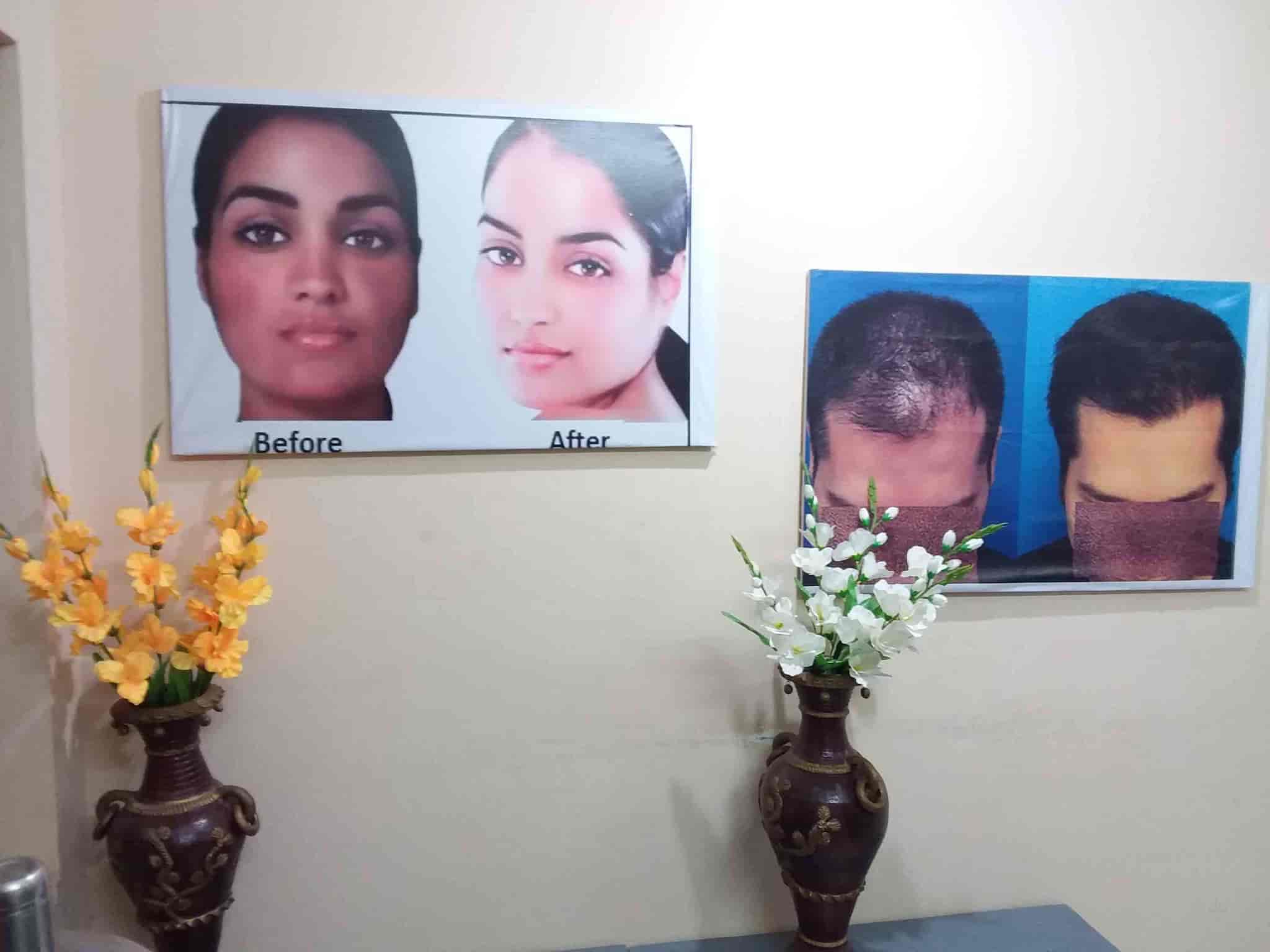 Best Laser Hair Removal Treatment In Madanapalle Book
