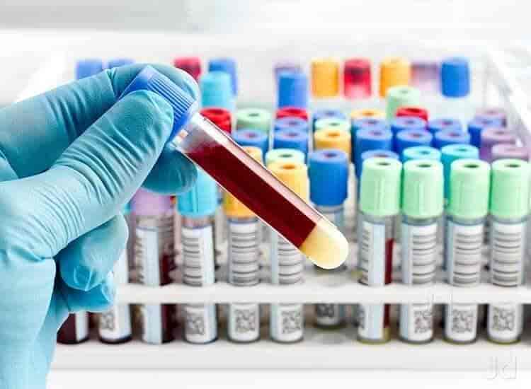 Lab view 6