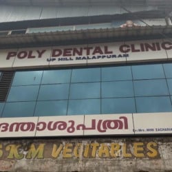 star smile makeover: This Is What Professionals Do