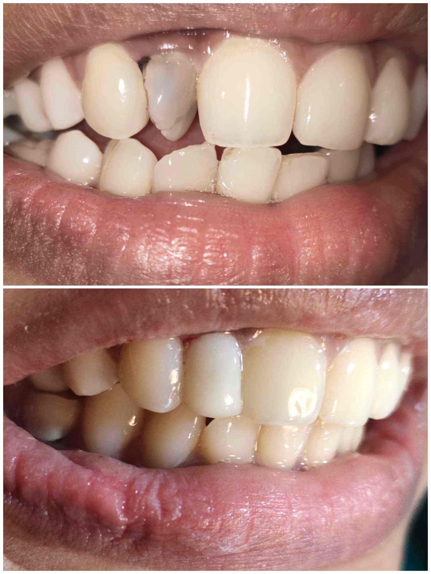 Zain Dental Clinic in Malappuram Best Dental Clinics in Malappuram