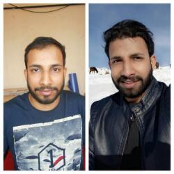 Cochin Hair Transplantation in Perintalmanna - Best Hair Transplant Clinics in Malappuram - Justdial Cochin Hair Transplantation in Perintalmanna - Best Hair Transplant Clinics in Malappuram - Justdial
