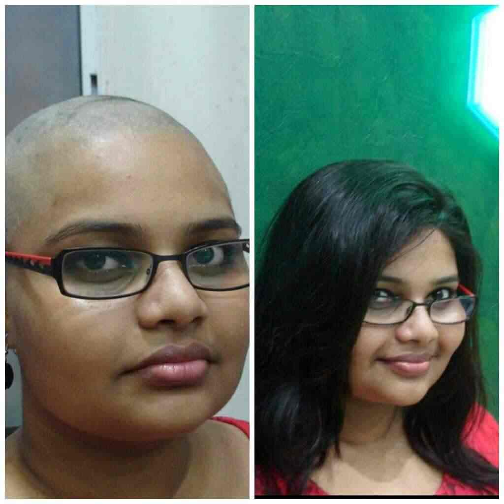 Natural Hair Fixing Center Photos Falnir Mangalore Pictures