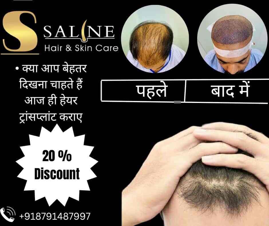 Saline Hair & Skin Care in Hapur Road,Meerut Best Hair Transplant