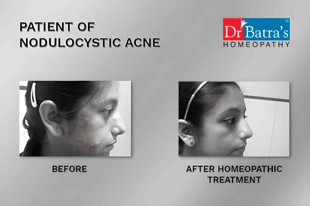 Find list of Dr Batras in Santacruz East, Mumbai near me Justdial