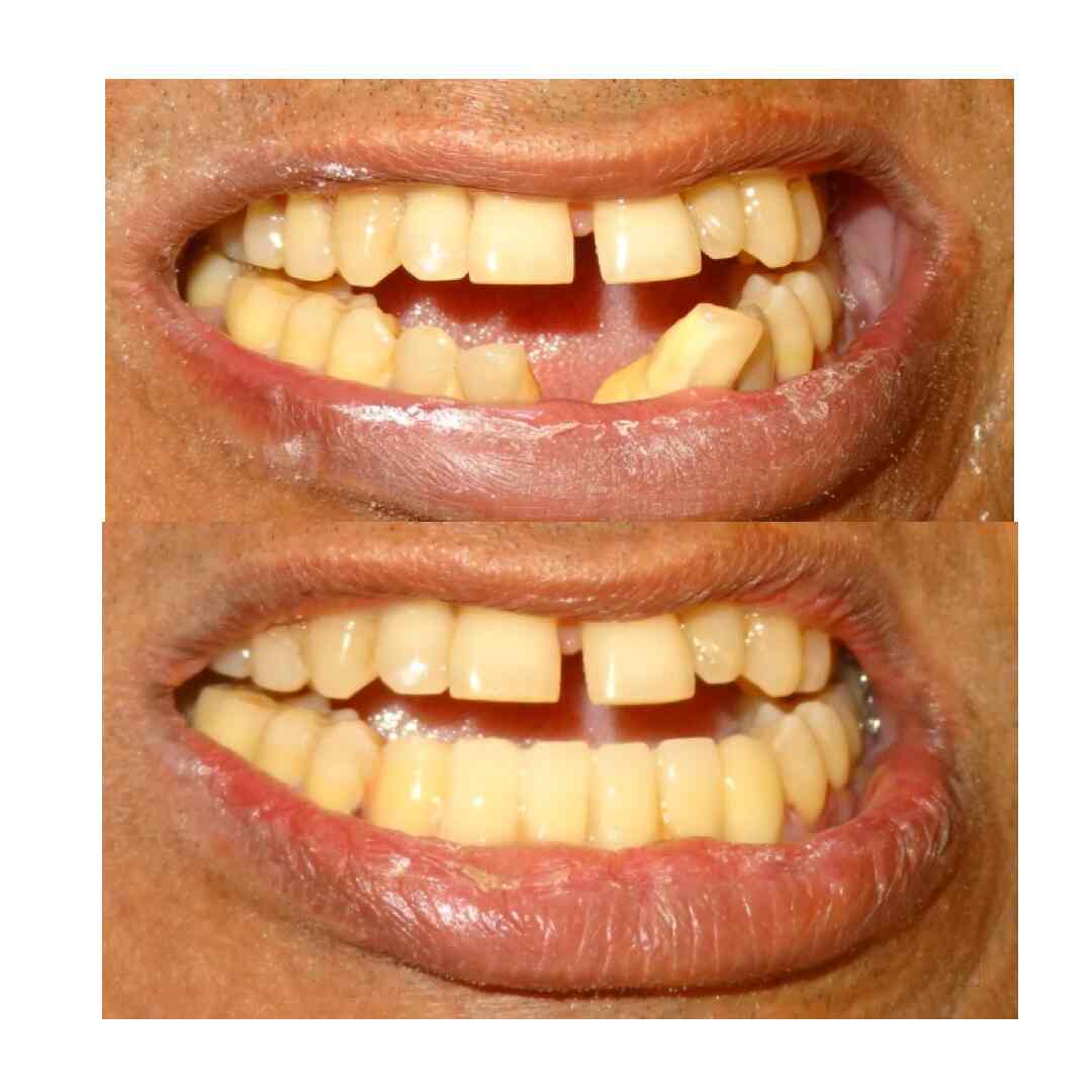 Dr Cherrys Dental Studio in Malad East,Mumbai Best Dental Clinics in