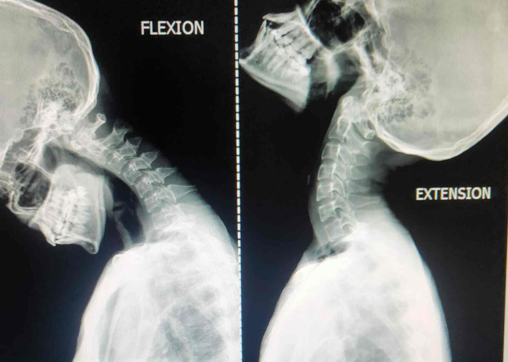 Top 24 Hours X Ray Centres near Lotus Ent HospitalGhatkopar East