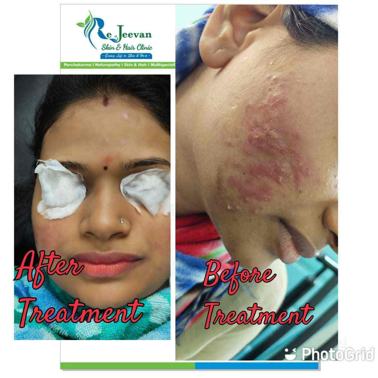 Rejeevan in Kalyan West,Mumbai Best Ayurvedic Doctors in Mumbai