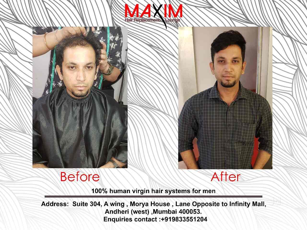 Maxim Hair Replacement Lounge Photos Andheri West Mumbai